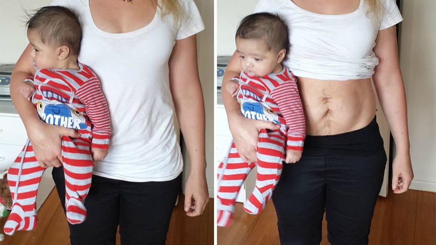 A more realistic image of 14 weeks postpartum.